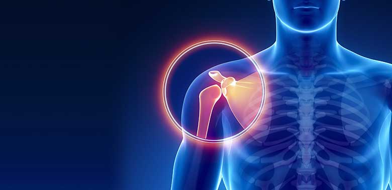 Suture Anchor Fixation...