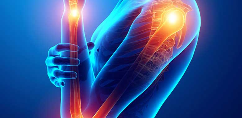 Üst Ekstremite Replantasyon ve Revaskülarizasyonu